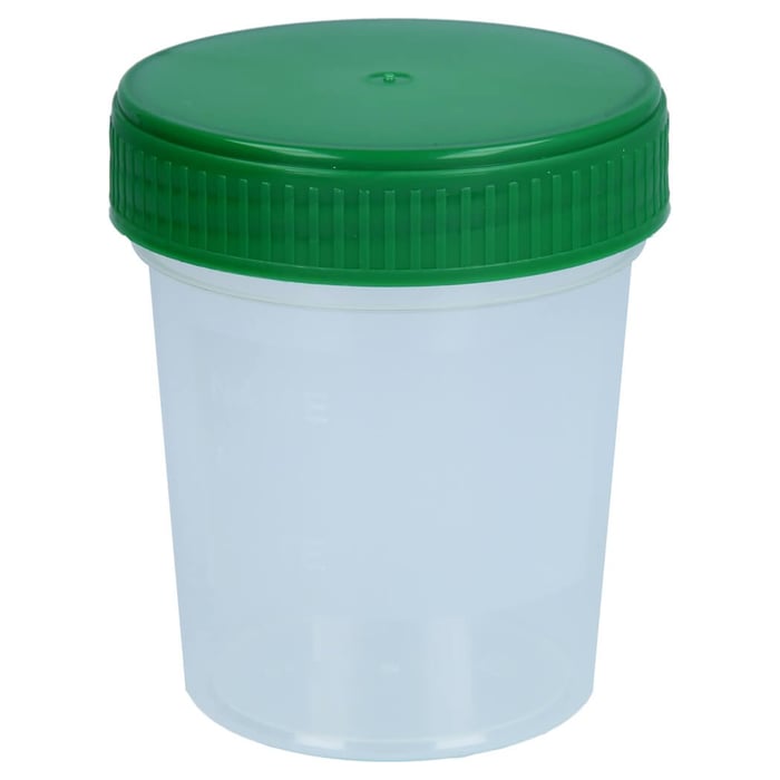 Urinbecher mit Schraubdeckel