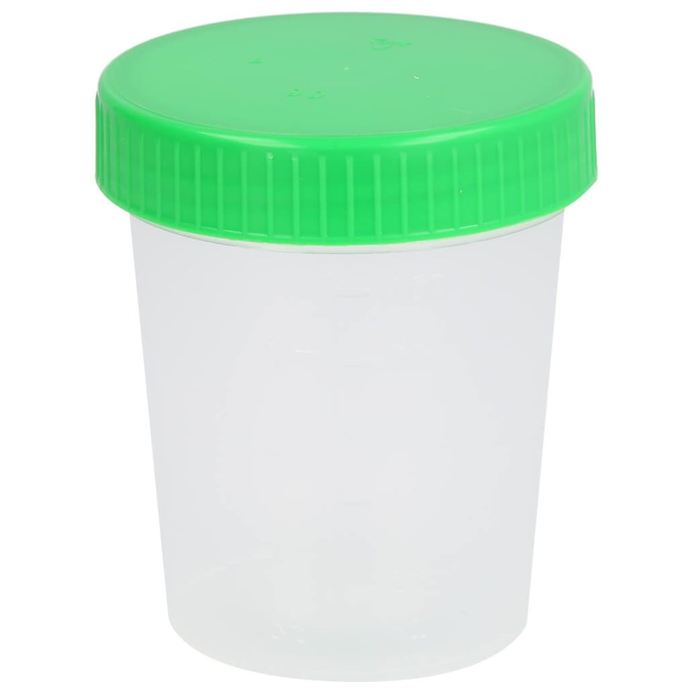 Urinbecher mit Schraubdeckel