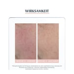 Eucerin SEH AntiRÖTUNGEN Beruhigende Pflege Produktbild 5