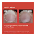 Isdin Si-Nails Nagelhärter Stift Produktbild 10