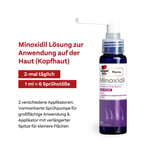 Minoxidil Doppelherzpharma 20 mg/ml Frauen