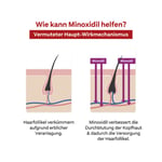 Minoxidil Doppelherzpharma 20 mg/ml Frauen