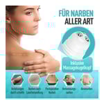 Flint Med Narbengel