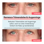 Remescar Tränensäcke und Augenringe