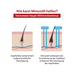 Minoxidil DoppelherzPharma Männer 50 mg/g
