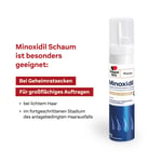 Minoxidil DoppelherzPharma Männer 50 mg/g