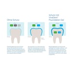 Vivadent Fluoridation Gel