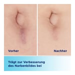BEPANCARE Narben-Gel