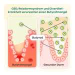 Butyzol mikroverkapseltes Natriumbutyrat Apriwell Hartkapseln Produktbild 4