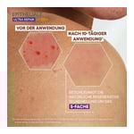 A-DERMA EPITHELIALE ULTRA Repair Creme LSF 50+