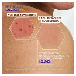 A-DERMA EPITHELIALE ULTRA Repair Creme LSF 50+