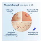 EVOLSIN Dellwarzen Mittel Lösung