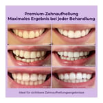 ONLYSMILE Zahnbleaching Set professionell