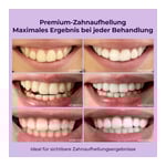 ONLYSMILE Zahnaufhellungsgel