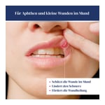 URGO APHTHEN Junior Gel